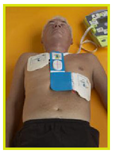 pads aed rhythm heart aeds electrode piece use victims analysing external